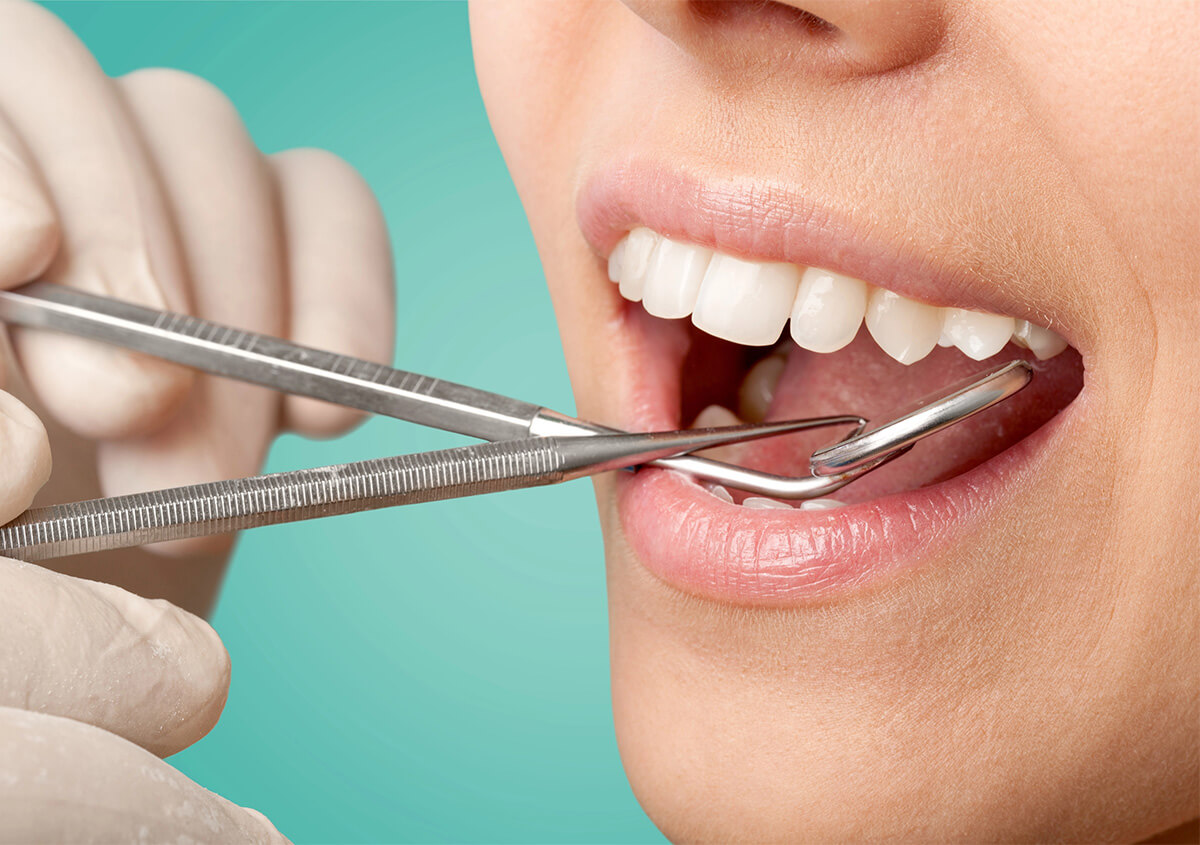 Eight Interesting Things to Know About Cavities and Fillings